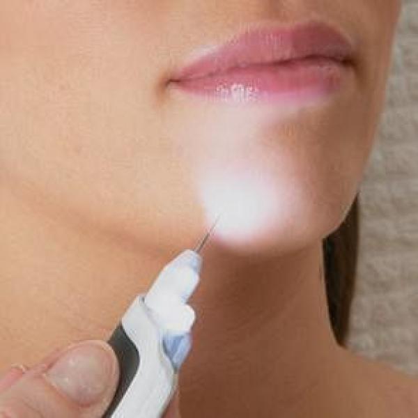 ЭЛЕКТРОЭПИЛЯТОР DA LIGHT 501 Classic needle ЭЛЕКТРОЭПИЛЯТОР DA LIGHT 501 Classic needle