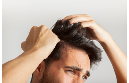 Выпадение волос у мужчин - это многомиллиардная отрасль (и она продолжает расти)  